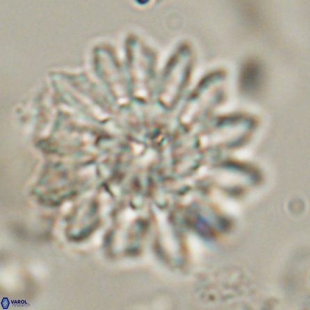 Discoaster splendidus 57123