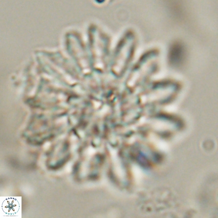 Discoaster splendidus 57123