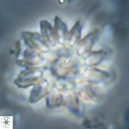 Discoaster splendidus 57124