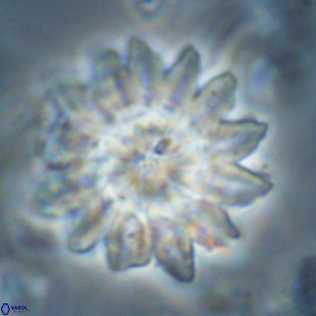 Discoaster splendidus 57125