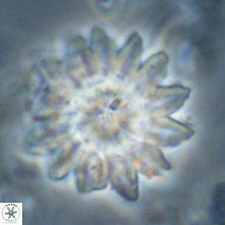 Discoaster splendidus 57125