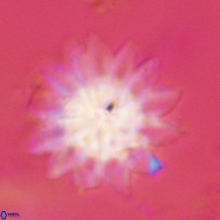 Discoaster splendidus 57127