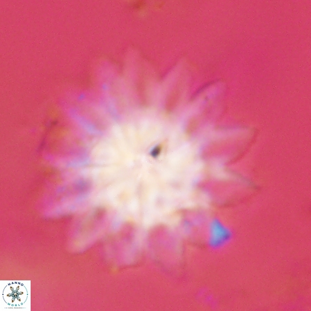 Discoaster splendidus 57127