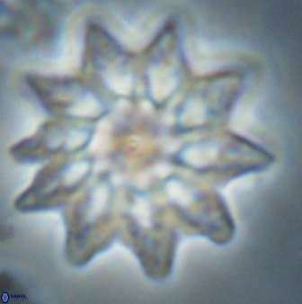 Discoaster splendidus 58249