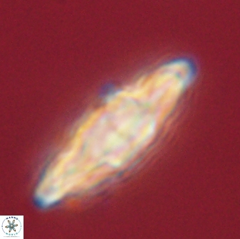 Discoaster splendidus 58256
