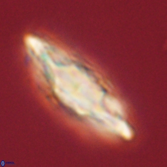 Discoaster splendidus 58260