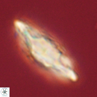 Discoaster splendidus 58260