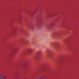 Discoaster splendidus 58261