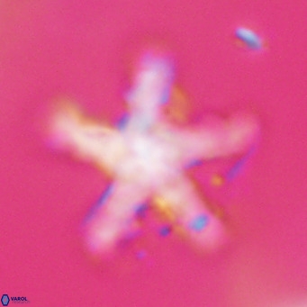 Discoaster tanii VR 32771