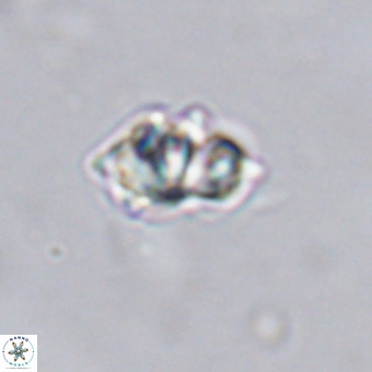 Discoaster tokerae VR 20025
