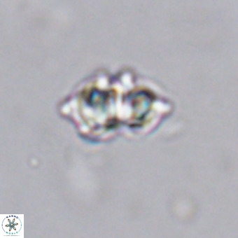Discoaster tokerae VR 20026