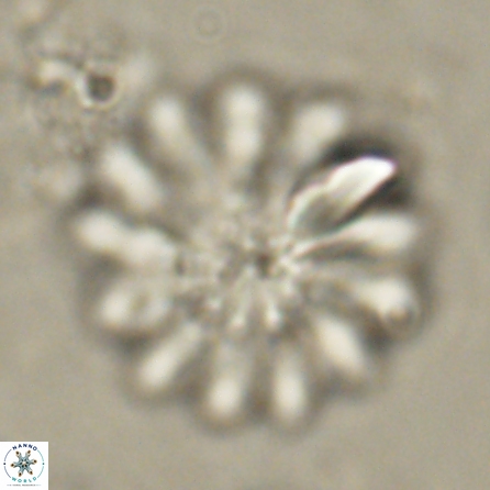 Discoaster tortinodosus 60721