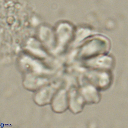 Discoaster tortinodosus 60722