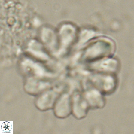 Discoaster tortinodosus 60722