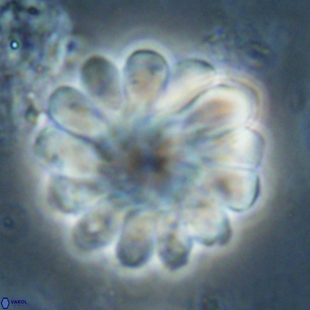 Discoaster tortinodosus 60723