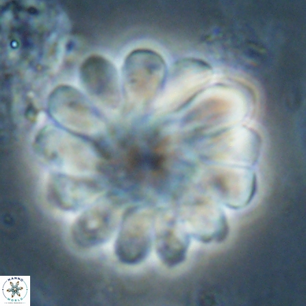 Discoaster tortinodosus 60723