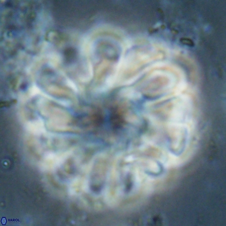 Discoaster tortinodosus 60724