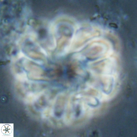 Discoaster tortinodosus 60724