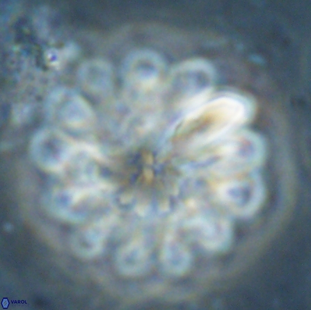 Discoaster tortinodosus 60725