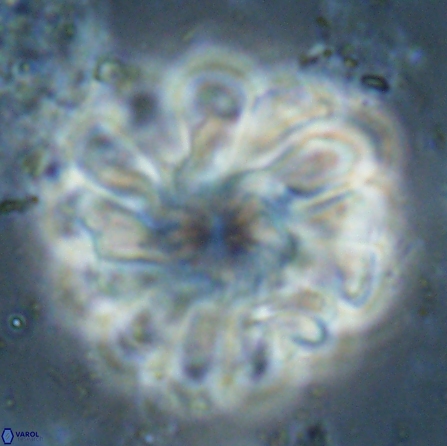 Discoaster tortinodosus 60726
