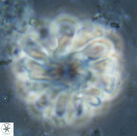 Discoaster tortinodosus 60726