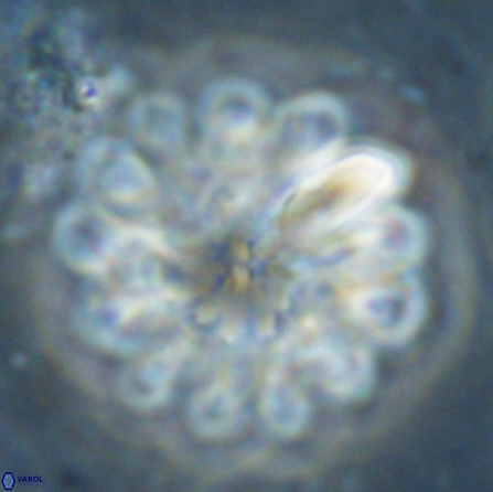 Discoaster tortinodosus 60727