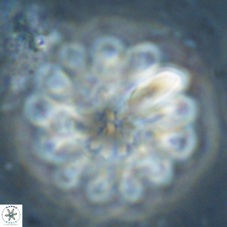 Discoaster tortinodosus 60727