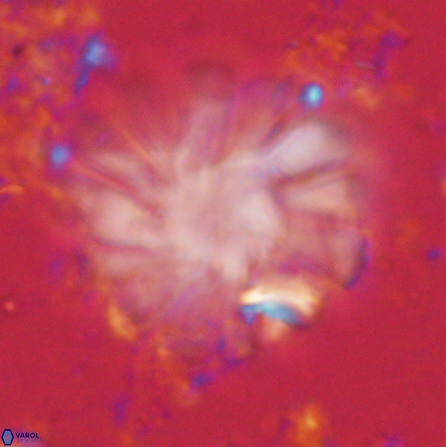 Discoaster tortinodosus 60728