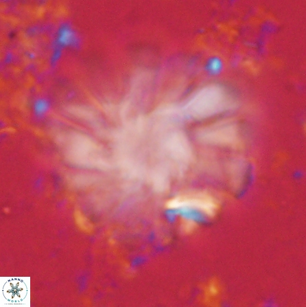 Discoaster tortinodosus 60728