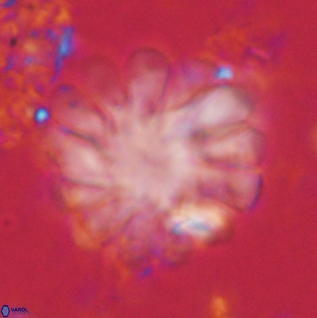 Discoaster tortinodosus 60731