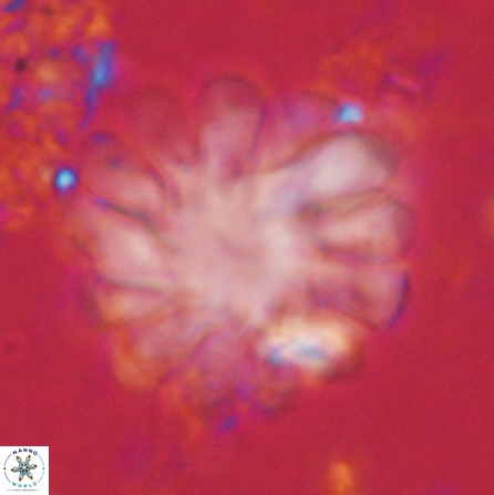 Discoaster tortinodosus 60731