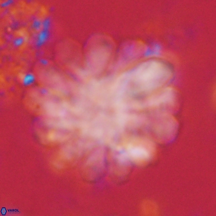 Discoaster tortinodosus 60732