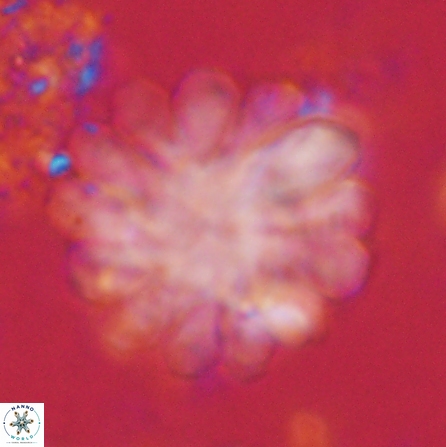 Discoaster tortinodosus 60732