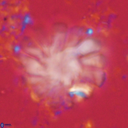 Discoaster tortinodosus 60735