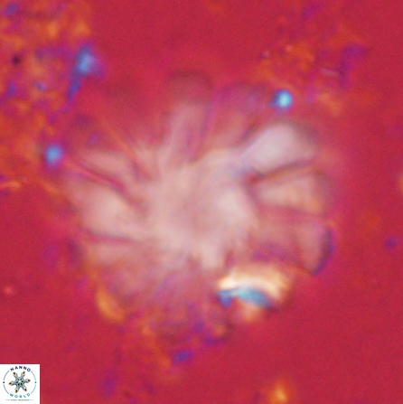 Discoaster tortinodosus 60735