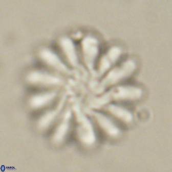 Discoaster tortinodosus 60840