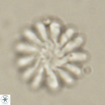Discoaster tortinodosus 60840
