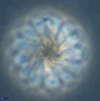 Discoaster tortinodosus 60841
