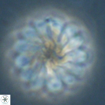 Discoaster tortinodosus 60841