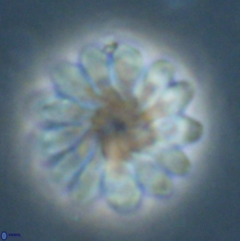 Discoaster tortinodosus 60842
