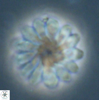 Discoaster tortinodosus 60842
