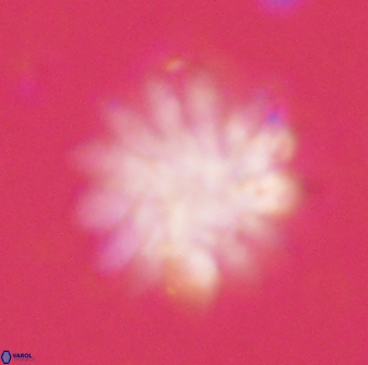 Discoaster tortinodosus 60843