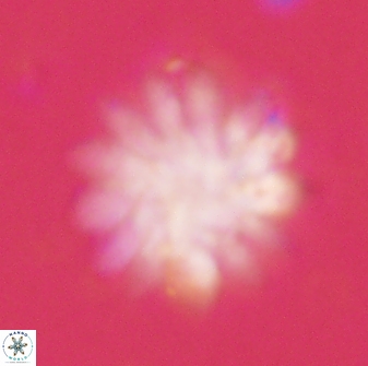Discoaster tortinodosus 60843