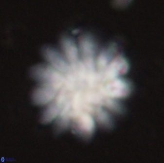 Discoaster tortinodosus 60844