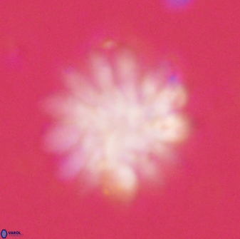 Discoaster tortinodosus 60845