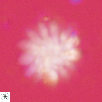Discoaster tortinodosus 60845