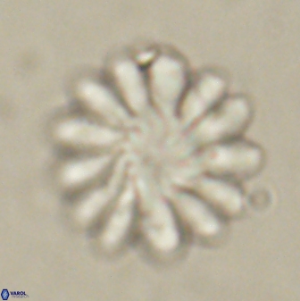 Discoaster tortinodosus 60839