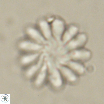 Discoaster tortinodosus 60839