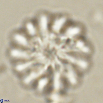 Discoaster tortinodosus 60975