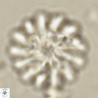 Discoaster tortinodosus 60975